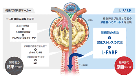 従来の腎疾患マーカーとの違い