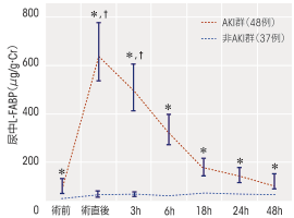 急性腎障害(AKI)
