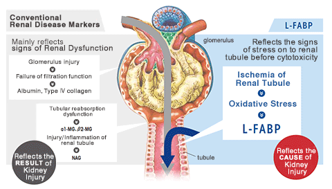 Difference between L-FABP and conventional renal disease markers