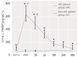 Acute Kidney Injury(AKI)