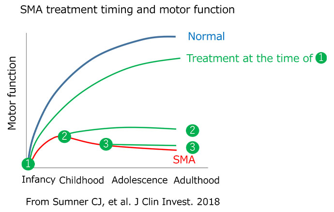 SMA treatment timing and motor function